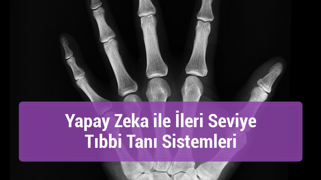 Yapay Zeka ile İleri Seviye Tıbbi Tanı Sistemleri